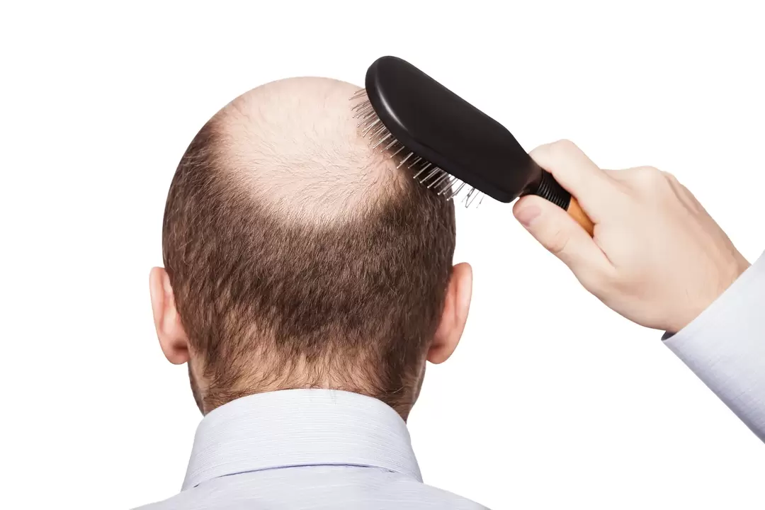 Bolding and treatment with a spray Verdexedil